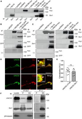 Syntaxin-1 is necessary for UNC5A-C/Netrin-1-dependent macropinocytosis and chemorepulsion